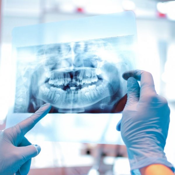 צילום שיניים – אורתודנטיה צילום שיניים - אורתודנטיה